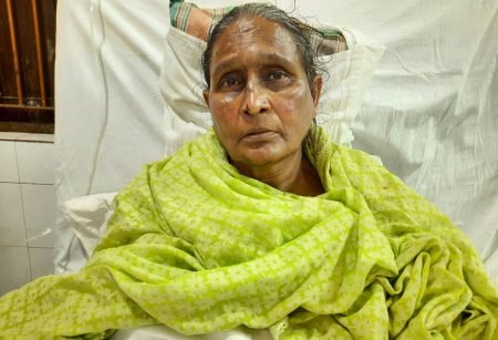 কুড়িগ্রাম ৪ আসনের সাবেক সংসদ সদস্য আলহাজ্ব গোলাম হোসেন এর সহ ধর্মীনী সড়ক দূর্ঘটনায় আহত